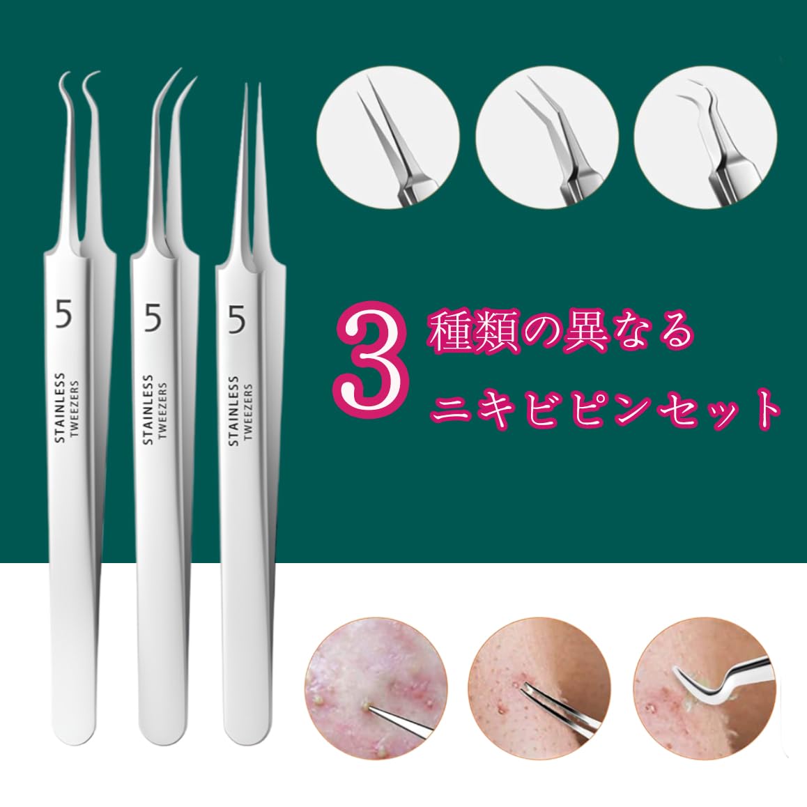 角栓ピンセット専用セット - 精密ピンセットで粉刺と黒ずみ精准去除!ニキビケアに最適、ステンレス鋼、超细尖头0.1mmで角栓取り&コメドプッシャー完璧毛穴ケア (8個セット)